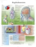 3B Scientific Lehrtafel - Kopfschmerzen